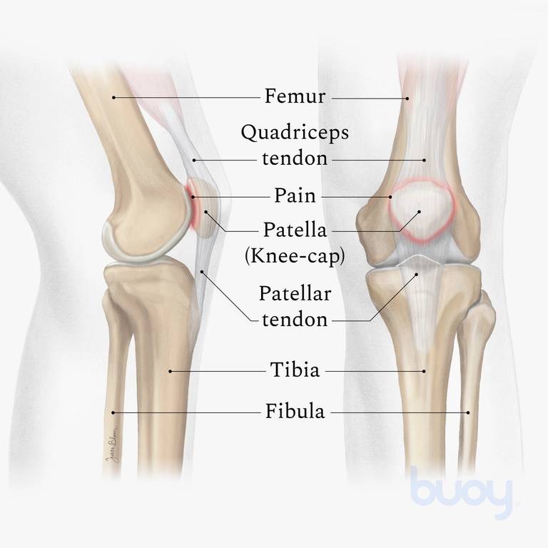 Diagram showing parts of the knee